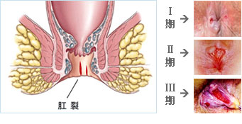 ѳѪ