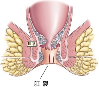 ѵ