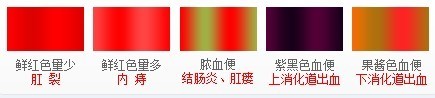 Ѫʲôԭ