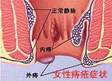 ̼ҪǮ