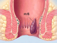 ôõ