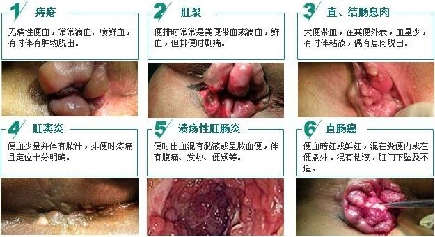 QQͼƬ20150320093130.jpg